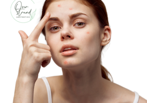 Biomedical Emporium: Anti-Acne Serum