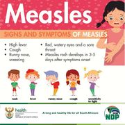 Safe and Effective Measles Vaccine For Children Under 15 Years