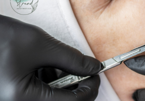 Free Skin Assessment