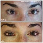 Top & bottom line tattooed