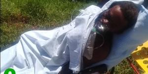 â€˜n  Ernstig  beseerde  plaaswerker  Lundi  Tshayinca, ook bekend as Patrick, nadat hy na bewering deur sy vriendin aangeval is.