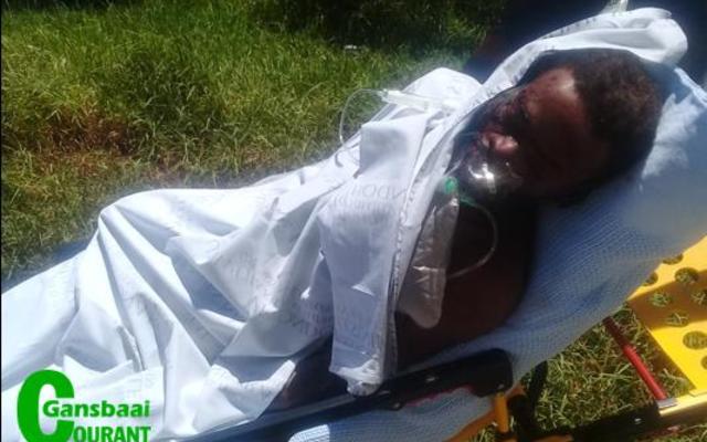 â€˜n  Ernstig  beseerde  plaaswerker  Lundi  Tshayinca, ook bekend as Patrick, nadat hy na bewering deur sy vriendin aangeval is.