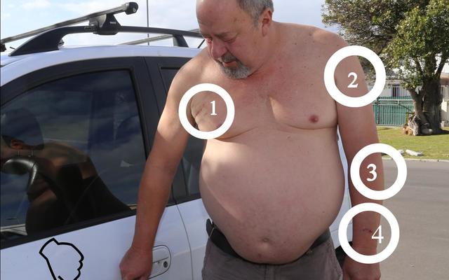 Jakkals Scholtz is kort na sy 60ste verjaardag 5 keer met â€˜n mes gesteek nadat hy met â€˜n slenter van die N2 afgedwing is.  Hy was oppad na Kaapstad Lughawe om sy vrou te gaan haal.  Hier wys hy na â€˜n bloedstreep teen sy motor wat agter gelaat is deur sy aanvaller. Hy vermoed die rower is deur die glasstukke van sy motor se stukkende passasiersruit gesny toe hy weggejaag het. 