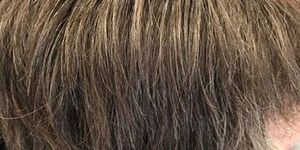 denise_before_1500536160