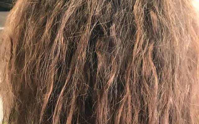 ronel_before_1500536162