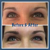 Microblading Your Eyebrows