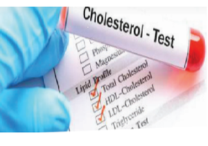 Beheer jou cholesterol - beskerm jouself teen â€™n hartaanval en â€™n beroerte