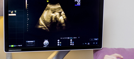 hermanus_medical_services_specialised_doctors_dr_adelene_esterhuizen_baby_sonars_1687775467