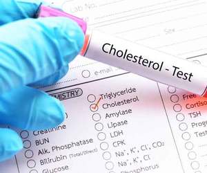 Why Are Statins Controversial?