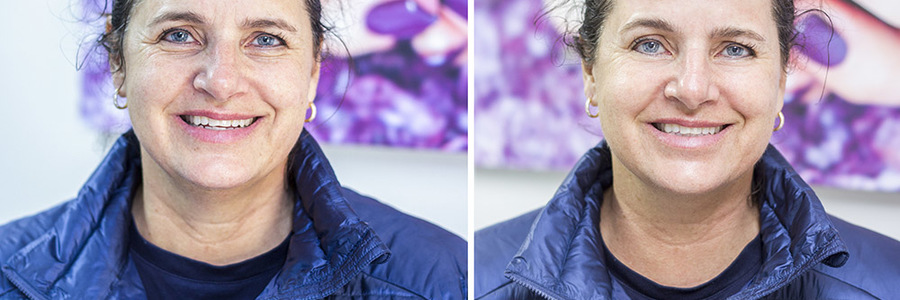 hermanus_beauty_salon_whale_beauty_and_bio_sculpture_before_and_after_black_diamond_treatment_1575547642