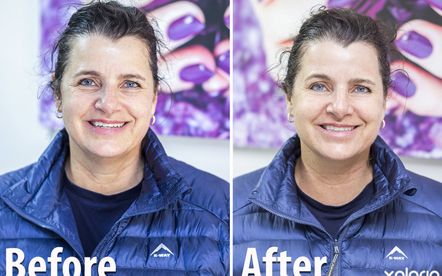 hermanus_beauty_salon_whale_beauty_and_bio_sculpture_before_and_after_black_diamond_treatment_1575547642 hermanus_beauty_salon_whale_beauty_and_bio_sculpture_before_and_after_black_diamond_treatment_1575547642