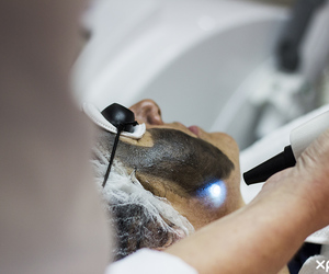 Black Diamond Laser Treatment