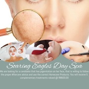 Candidate Needed ForÂ Pigmentation Removal Treatment