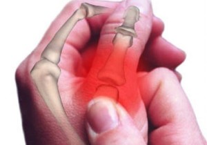 Voedsel wat met artritissimptome kan help